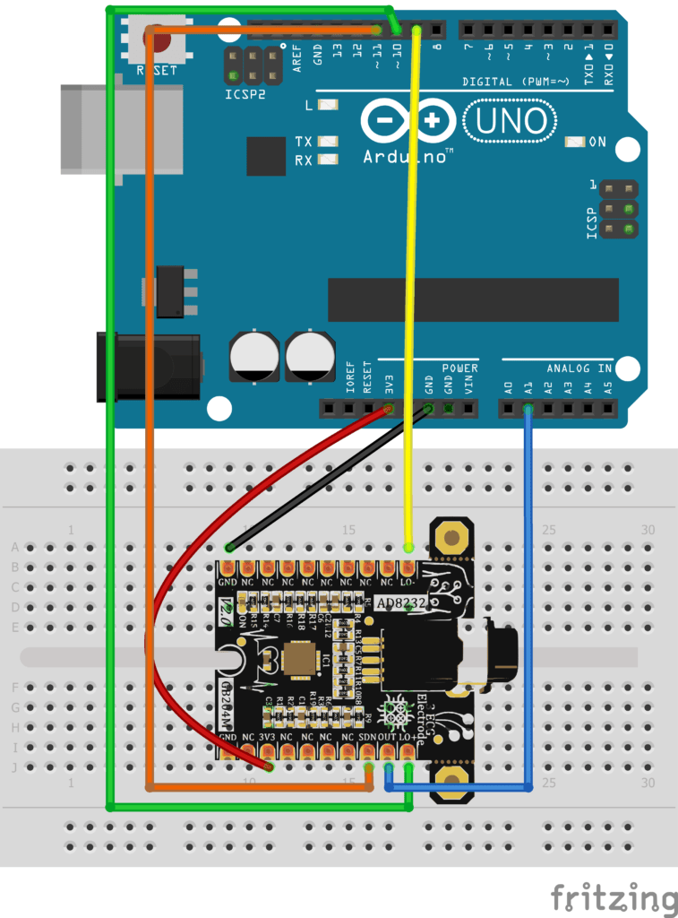 AD8232_arduino